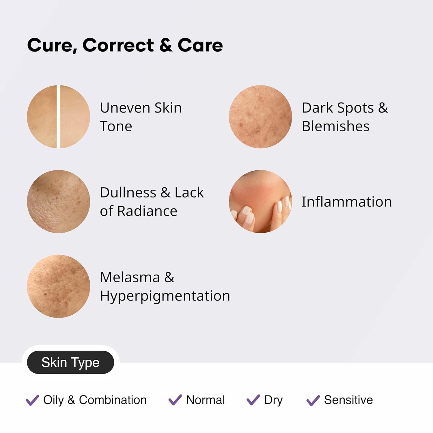 2 Pezzi Siero Sbiancante con A - Alpha Arbutin Serum recensione e prezzo