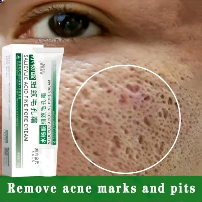 Crema per la pulizia dei pori  - Azelaic Acid Cream recensione e prezzo