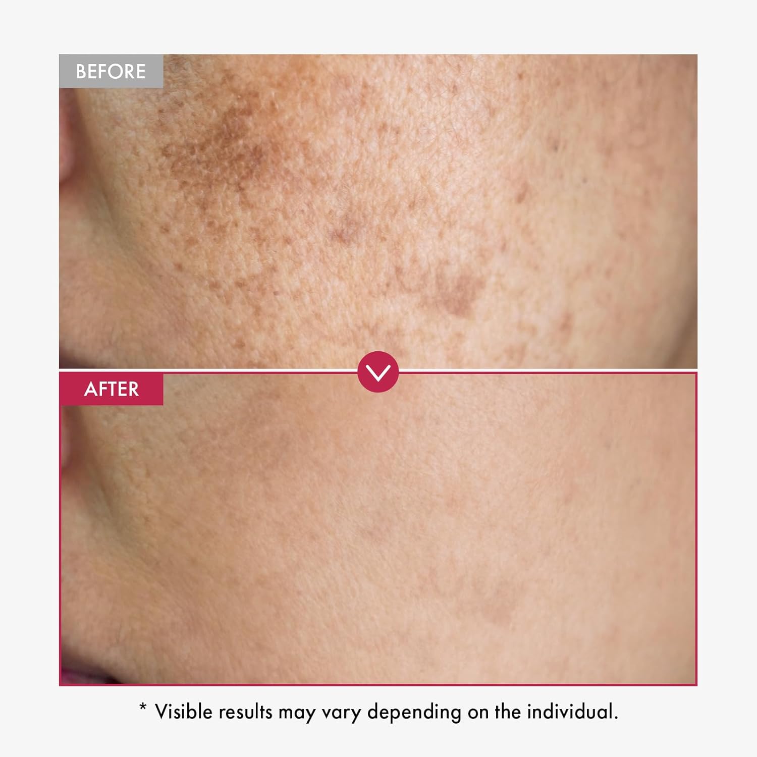 Siero alfa arbutina AHA mantie - Alpha Arbutin Serum recensione e prezzo