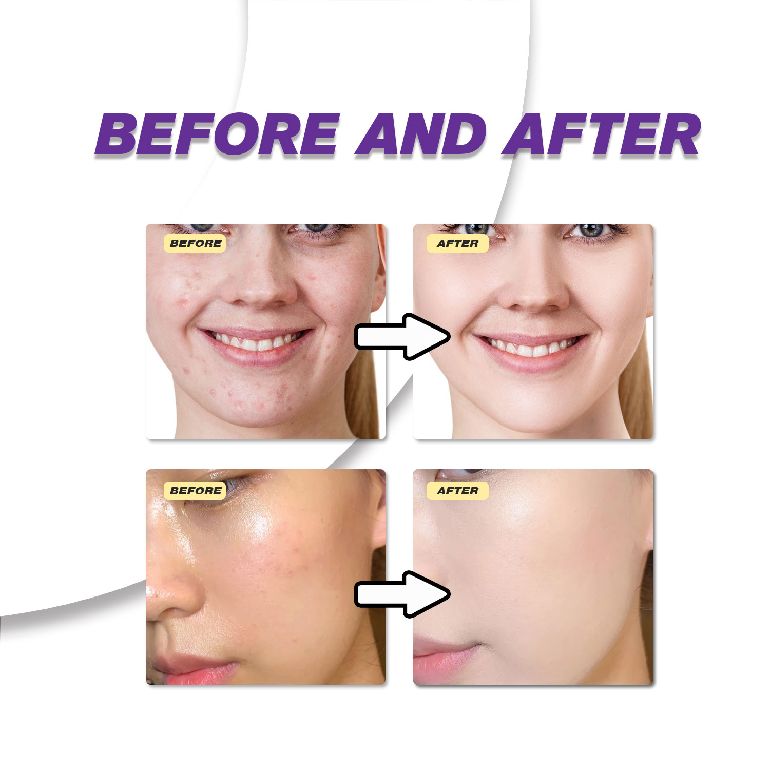 Crema all'Acido Azelaico Delic - Azelaic Acid Cream recensione e prezzo