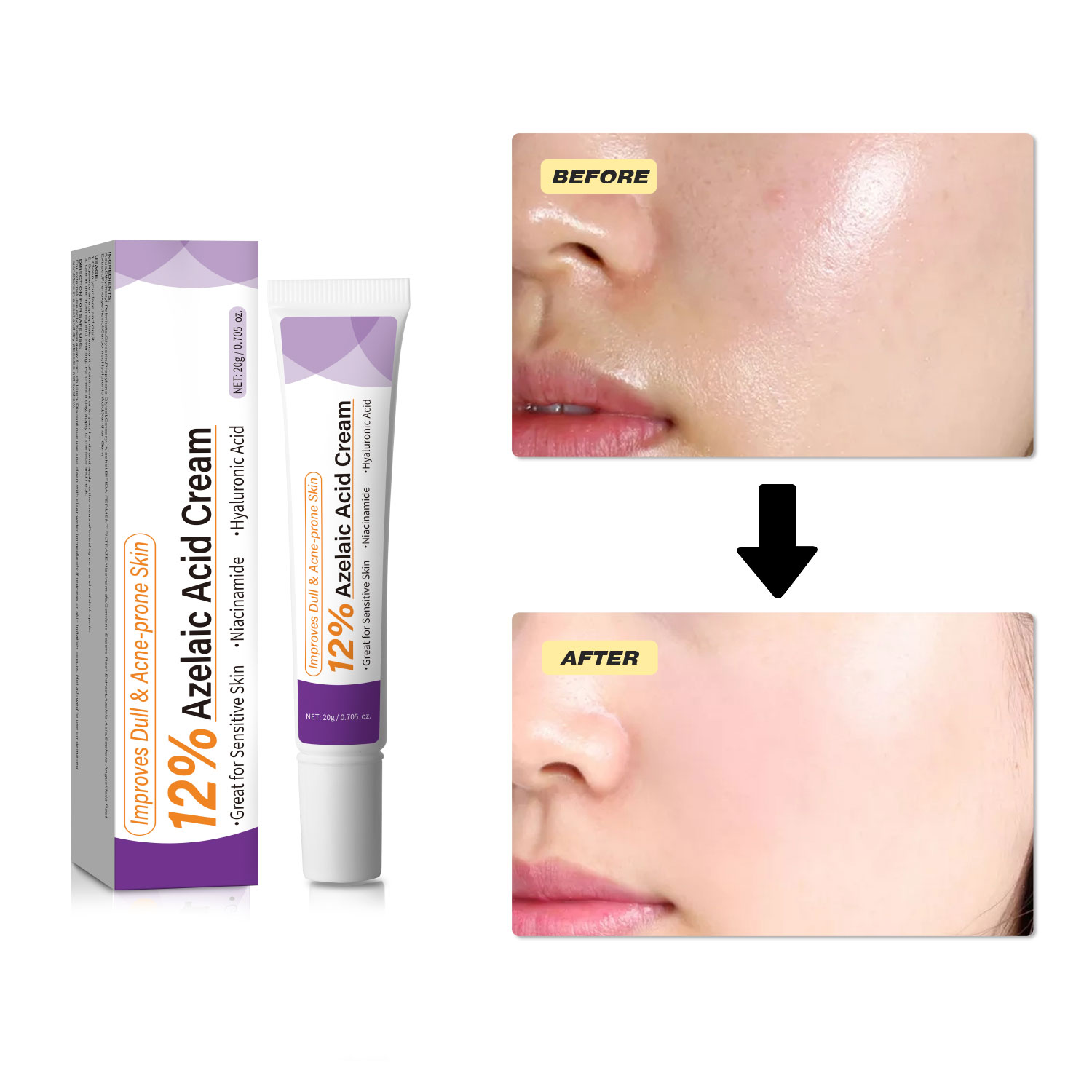 Crema all'Acido Azelaico Delic - Azelaic Acid Cream recensione e prezzo