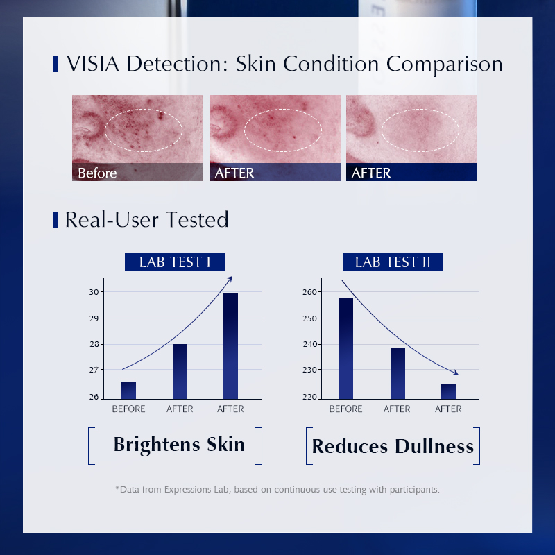 Siero Viso Niacinamide + Alfa  - Alpha Arbutin Serum recensione e prezzo